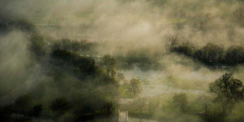 糖尿病足日常护理与检查：预防溃疡与截肢的关键步骤详解 | QX糖尿病管理